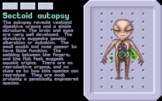 Sectoid Autopsy